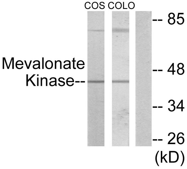 MVK Antibody - Western blot analysis of lysates from COS7 and COLO205 cells, using Mevalonate Kinase Antibody. The lane on the right is blocked with the synthesized peptide.