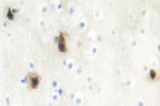 MVK Antibody - IHC of MVK (N175) pAb in paraffin-embedded human brain tissue.