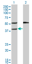 MVK Antibody - Western blot of MVK expression in transfected 293T cell line by MVK monoclonal antibody (M02), clone 2C5.