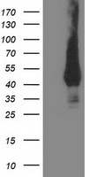 MVK Antibody - HEK293T cells were transfected with the pCMV6-ENTRY control (Left lane) or pCMV6-ENTRY MVK (Right lane) cDNA for 48 hrs and lysed. Equivalent amounts of cell lysates (5 ug per lane) were separated by SDS-PAGE and immunoblotted with anti-MVK.