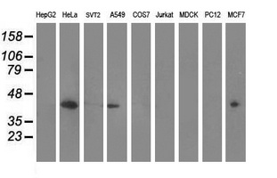 MVK Antibody - Western blot of extracts (35 ug) from 9 different cell lines by using anti-MVK monoclonal antibody (HepG2: human; HeLa: human; SVT2: mouse; A549: human; COS7: monkey; Jurkat: human; MDCK: canine; PC12: rat; MCF7: human).