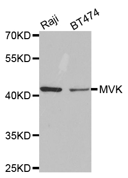 MVK Antibody - Western blot analysis of extracts of various cell lines.