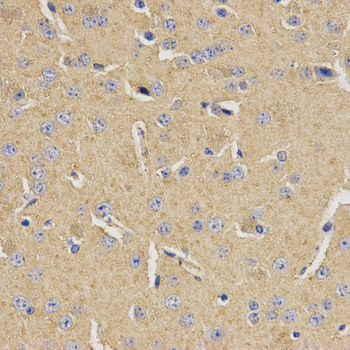 MVK Antibody - Immunohistochemistry of paraffin-embedded mouse brain tissue.