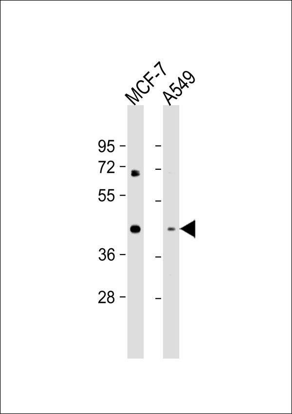 MVK Antibody - All lanes: Anti-MVK Antibody at 1:1000 dilution. Lane 1: MCF-7 whole cell lysate. Lane 2: A549 whole cell lysate Lysates/proteins at 20 ug per lane. Secondary Goat Anti-Rabbit IgG, (H+L), Peroxidase conjugated at 1:10000 dilution. Predicted band size: 42 kDa. Blocking/Dilution buffer: 5% NFDM/TBST.