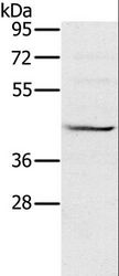 MVK Antibody - Western blot analysis of Raji cell, using MVK Polyclonal Antibody at dilution of 1:550.