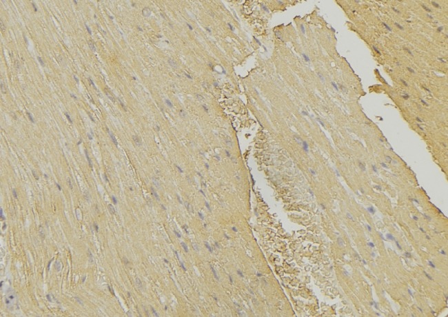 MVK Antibody - 1:100 staining mouse muscle tissue by IHC-P. The sample was formaldehyde fixed and a heat mediated antigen retrieval step in citrate buffer was performed. The sample was then blocked and incubated with the antibody for 1.5 hours at 22°C. An HRP conjugated goat anti-rabbit antibody was used as the secondary.