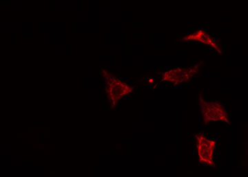 MVK Antibody - Staining HeLa cells by IF/ICC. The samples were fixed with PFA and permeabilized in 0.1% Triton X-100, then blocked in 10% serum for 45 min at 25°C. The primary antibody was diluted at 1:200 and incubated with the sample for 1 hour at 37°C. An Alexa Fluor 594 conjugated goat anti-rabbit IgG (H+L) antibody, diluted at 1/600, was used as secondary antibody.