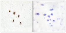 MVK Antibody - Peptide - + Immunohistochemistry analysis of paraffin-embedded human brain tissue using Mevalonate Kinase antibody.