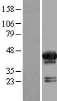MVK Protein - Western validation with an anti-DDK antibody * L: Control HEK293 lysate R: Over-expression lysate