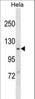MVP / VAULT1 Antibody - MVP Antibody (Ascites)western blot of HeLa cell line lysates (35 ug/lane). The MVP antibody detected the MVP protein (arrow).