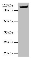 MVP / VAULT1 Antibody - Western blot All lanes: Major vault antibody at 2µg/ml + Rat lung tissue Secondary Goat polyclonal to rabbit IgG at 1/10000 dilution Predicted band size: 99 kDa Observed band size: 110 kDa