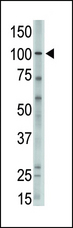 MVP / VAULT1 Antibody - The anti-MVP C-term Antibody is used in Western blot to detect MVP in A375 lysate.