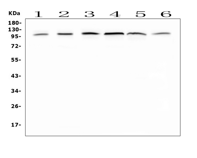 MVP / VAULT1 Antibody - Western blot analysis of MVP using anti-MVP antibody. Electrophoresis was performed on a 5-20% SDS-PAGE gel at 70V (Stacking gel) / 90V (Resolving gel) for 2-3 hours. The sample well of each lane was loaded with 50ug of sample under reducing conditions. Lane 1: human placenta tissue lysates,Lane 2: human HepG2 whole cell lysates, Lane 3: human A549 whole cell lysates, Lane 4: human PANC-1 whole cell lysates, Lane 5: human SGC-7901 whole cell lysates, Lane 6: human MDA-MB-231 whole cell lysates. After Electrophoresis, proteins were transferred to a Nitrocellulose membrane at 150mA for 50-90 minutes. Blocked the membrane with 5% Non-fat Milk/ TBS for 1.5 hour at RT. The membrane was incubated with rabbit anti-MVP antigen affinity purified polyclonal antibody at 0.5 µg/mL overnight at 4°C, then washed with TBS-0.1% Tween 3 times with 5 minutes each and probed with a goat anti-rabbit IgG-HRP secondary antibody at a dilution of 1:10000 for 1.5 hour at RT. The signal is developed using an Enhanced Chemiluminescent detection (ECL) kit with Tanon 5200 system. A specific band was detected for MVP at approximately 99KD. The expected band size for MVP is at 99KD.