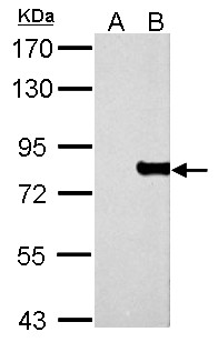 MX1 / MX Antibody - detects protein by Western blot analysis. A. 30 ug 293T whole cell lysate/extract. B. 30 ug whole cell lysate/extract of human MX1-transfected 293T cells. 7.5 % SDS-PAGE. dilution:1:5000