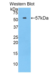MX1 / MX Antibody - Western blot of recombinant MX1 / MX.  This image was taken for the unconjugated form of this product. Other forms have not been tested.
