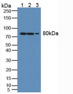 MX1 / MX Antibody - Western Blot; Sample: Lane1: Human A549 Cells; Lane2: Mouse Lung Tissue; Lane3: Mouse Spleen Tissue.
