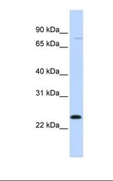 MX1 / MX Antibody - Hela cell lysate. Antibody concentration: 1.0 ug/ml. Gel concentration: 12%.  This image was taken for the unconjugated form of this product. Other forms have not been tested.