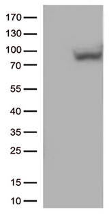 MX1 / MX Antibody - HEK293T cells were transfected with the pCMV6-ENTRY control. (Left lane) or pCMV6-ENTRY MX1. (Right lane) cDNA for 48 hrs and lysed. Equivalent amounts of cell lysates. (5 ug per lane) were separated by SDS-PAGE and immunoblotted with anti-MX1. (1:500)