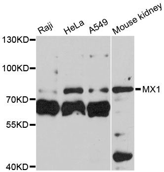 MX1 / MX Antibody - Western blot analysis of extracts of various cell lines, using MX1 antibody at 1:3000 dilution. The secondary antibody used was an HRP Goat Anti-Rabbit IgG (H+L) at 1:10000 dilution. Lysates were loaded 25ug per lane and 3% nonfat dry milk in TBST was used for blocking. An ECL Kit was used for detection and the exposure time was 90s.