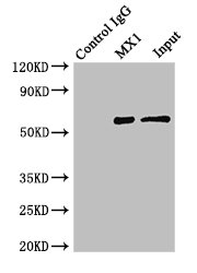 MX1 / MX Antibody - Immunoprecipitating MX1 in Hela whole cell lysate;Lane 1: Rabbit monoclonal IgG(1ug)instead of MX1 Antibody in Hela whole cell lysate.For western blotting, a HRP-conjugated light chain specific antibody was used as the Secondary antibody (1/50000);Lane 2: MX1 Antibody(4ug)+ Hela whole cell lysate(500ug);Lane 3: Hela whole cell lysate (20ug);