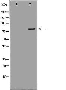 MX1 / MX Antibody - Western blot analysis of extracts of mouse spleen tissue using MX1 antibody. The lane on the left is treated with the antigen-specific peptide.