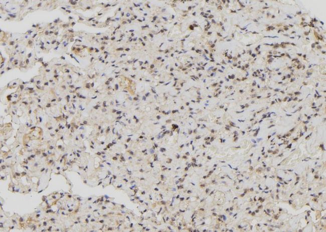 MX1 / MX Antibody - 1:100 staining human lung tissue by IHC-P. The sample was formaldehyde fixed and a heat mediated antigen retrieval step in citrate buffer was performed. The sample was then blocked and incubated with the antibody for 1.5 hours at 22°C. An HRP conjugated goat anti-rabbit antibody was used as the secondary.
