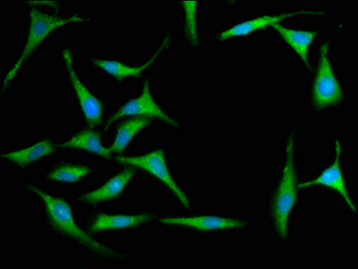MX2 Antibody - Immunofluorescence staining of Hela cells at a dilution of 1:100, counter-stained with DAPI. The cells were fixed in 4% formaldehyde, permeabilized using 0.2% Triton X-100 and blocked in 10% normal Goat Serum. The cells were then incubated with the antibody overnight at 4 °C.The secondary antibody was Alexa Fluor 488-congugated AffiniPure Goat Anti-Rabbit IgG (H+L) .
