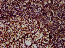 MX2 Antibody - Immunohistochemistry image at a dilution of 1:300 and staining in paraffin-embedded human tonsil tissue performed on a Leica BondTM system. After dewaxing and hydration, antigen retrieval was mediated by high pressure in a citrate buffer (pH 6.0) . Section was blocked with 10% normal goat serum 30min at RT. Then primary antibody (1% BSA) was incubated at 4 °C overnight. The primary is detected by a biotinylated secondary antibody and visualized using an HRP conjugated SP system.