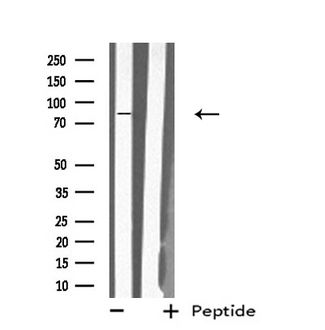 MX2 Antibody - Western blot analysis of extracts of 293 cells using MX2 antibody.