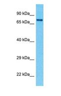 MX2 Antibody - Western blot of MX2 Antibody with 721_B Whole Cell lysate.  This image was taken for the unconjugated form of this product. Other forms have not been tested.
