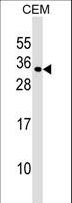 MXD1 / MAD1 Antibody - MXD1 Antibody western blot of CEM cell line lysates (35 ug/lane). The MXD1 antibody detected the MXD1 protein (arrow).