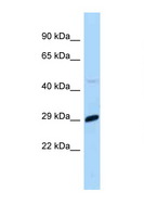 MXD1 / MAD1 Antibody - MXD1 / MAD antibody Western blot of Mouse Liver lysate. Antibody concentration 1 ug/ml.  This image was taken for the unconjugated form of this product. Other forms have not been tested.