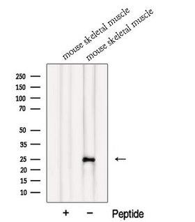 MXD1 / MAD1 Antibody - Western blot analysis of extracts of HepG2 cells using MXD1 antibody. The lane on the left was treated with blocking peptide.