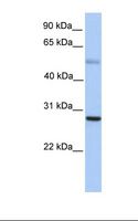 MXD1 / MAD1 Antibody - Fetal muscle lysate. Antibody concentration: 1.0 ug/ml. Gel concentration: 12%.  This image was taken for the unconjugated form of this product. Other forms have not been tested.