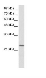 MXD3 / MAD3 Antibody - Transfected 293T Cell Lysate.  This image was taken for the unconjugated form of this product. Other forms have not been tested.