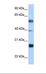 MXD3 / MAD3 Antibody - Transfected 293T cell lysate. Antibody concentration: 1.0 ug/ml. Gel concentration: 12%.  This image was taken for the unconjugated form of this product. Other forms have not been tested.