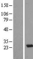 MXD3 / MAD3 Protein - Western validation with an anti-DDK antibody * L: Control HEK293 lysate R: Over-expression lysate