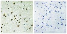 MXD4 Antibody - Immunohistochemistry analysis of paraffin-embedded human brain tissue, using MAD4 Antibody. The picture on the right is blocked with the synthesized peptide.