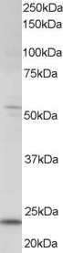 MXD4 Antibody - Antibody staining (0.5 ug/ml) of human kidney lysate (RIPA buffer, 35 ug total protein per lane). Primary incubated for 1 hour. Detected by Western blot of chemiluminescence.