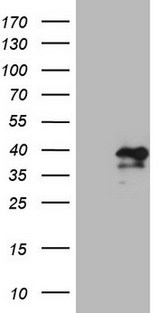MXD4 Antibody - HEK293T cells were transfected with the pCMV6-ENTRY control. (Left lane) or pCMV6-ENTRY MXD4. (Right lane) cDNA for 48 hrs and lysed. Equivalent amounts of cell lysates. (5 ug per lane) were separated by SDS-PAGE and immunoblotted with anti-MXD4. (1:2000)