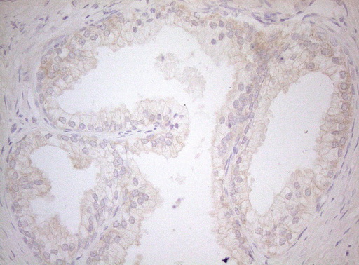 MXD4 Antibody - Immunohistochemical staining of paraffin-embedded Human prostate tissue within the normal limits using anti-MXD4 mouse monoclonal antibody. (Heat-induced epitope retrieval by 1mM EDTA in 10mM Tris buffer. (pH8.5) at 120°C for 3 min. (1:150)