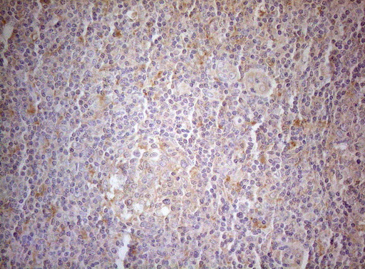MXD4 Antibody - Immunohistochemical staining of paraffin-embedded Human tonsil within the normal limits using anti-MXD4 mouse monoclonal antibody. (Heat-induced epitope retrieval by 1mM EDTA in 10mM Tris buffer. (pH8.5) at 120°C for 3 min. (1:150)