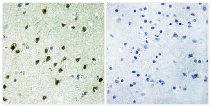 MXD4 Antibody - Peptide - + Immunohistochemistry analysis of paraffin-embedded human brain tissue, using MAD4 antibody.