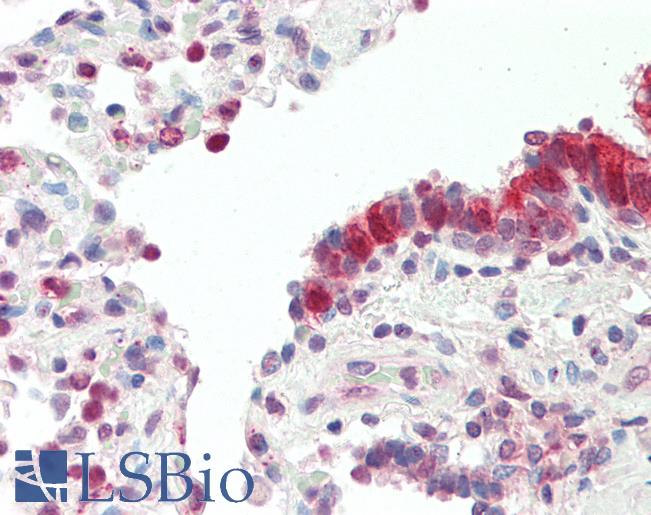 MXD4 Antibody - Human, Lung: Foramlin-Fixed Paraffin-Embedded  (FFPE).  This image was taken for the unconjugated form of this product. Other forms have not been tested.