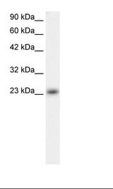 MXD4 Antibody - Fetal Heart Lysate.  This image was taken for the unconjugated form of this product. Other forms have not been tested.