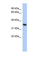 MXI1 / MAD2 Antibody - MXI1 antibody Western blot of SH-SYSY lysate. This image was taken for the unconjugated form of this product. Other forms have not been tested.