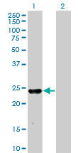 MXI1 / MAD2 Antibody - Western Blot analysis of MXI1 expression in transfected 293T cell line by MXI1 monoclonal antibody (M08), clone 1F3.Lane 1: MXI1 transfected lysate(26.1 KDa).Lane 2: Non-transfected lysate.