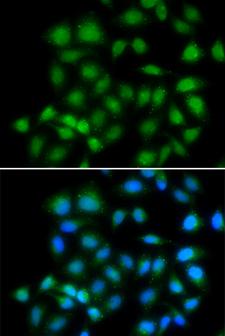 MXI1 / MAD2 Antibody - Immunofluorescence analysis of HeLa cells.