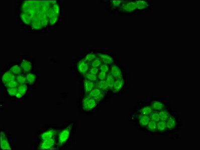 MXI1 / MAD2 Antibody - Immunofluorescent analysis of PC3 cells diluted at 1:100 and Alexa Fluor 488-congugated AffiniPure Goat Anti-Rabbit IgG(H+L)