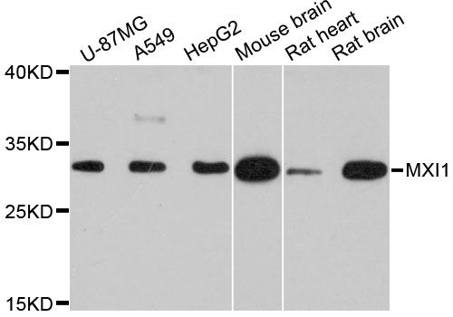 MXI1 / MAD2 Antibody - Western blot analysis of extracts of various cell lines, using MXI1 antibody at 1:3000 dilution. The secondary antibody used was an HRP Goat Anti-Rabbit IgG (H+L) at 1:10000 dilution. Lysates were loaded 25ug per lane and 3% nonfat dry milk in TBST was used for blocking. An ECL Kit was used for detection and the exposure time was 30s.